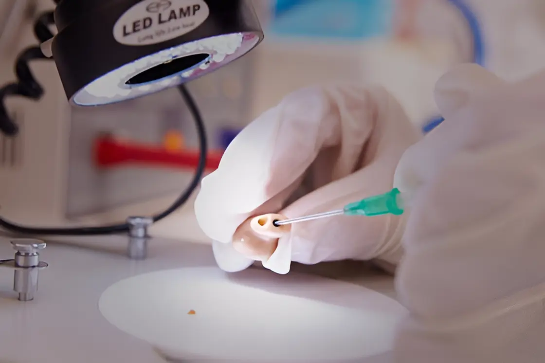 Hearing-Aid-Maintenance-and-Repair. |Excel Audiology