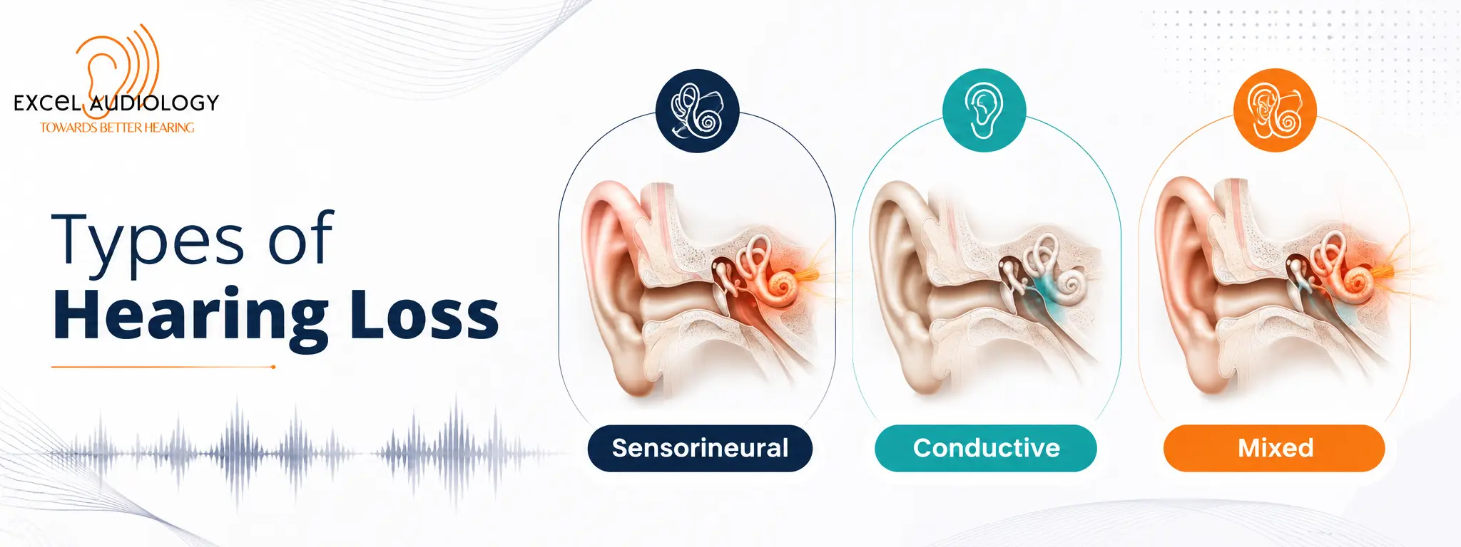 Types of hearing loss Types of Hearing Loss | Best Audiologist in Royal Oak Michigan | Excel Audiology